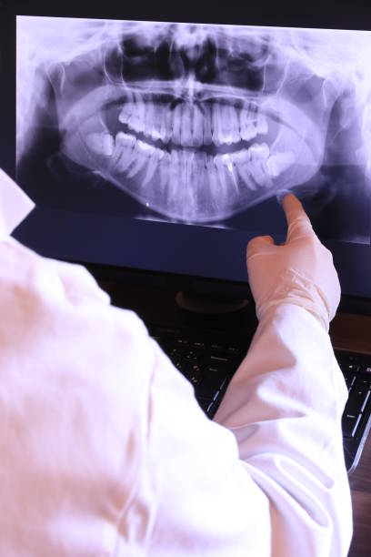 Best Urgent Dental Care for Toothache in Cajahs Mountain, NC