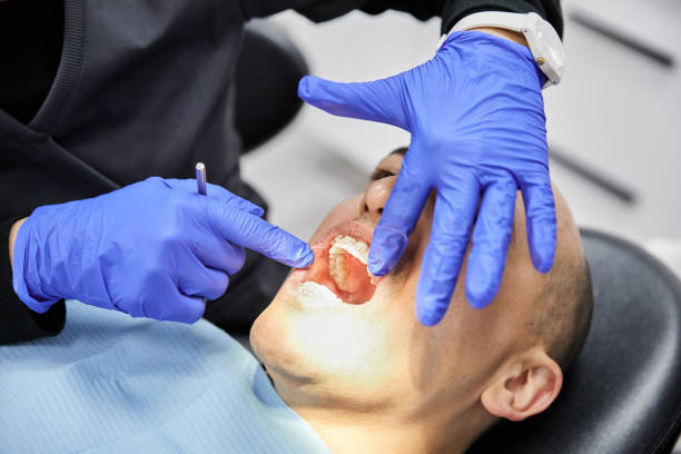Best Emergency Dentist for Lost Fillings or Crowns in Cajahs Mountain, NC